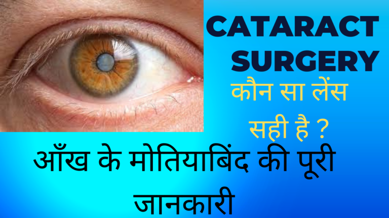 cataract surgery cost